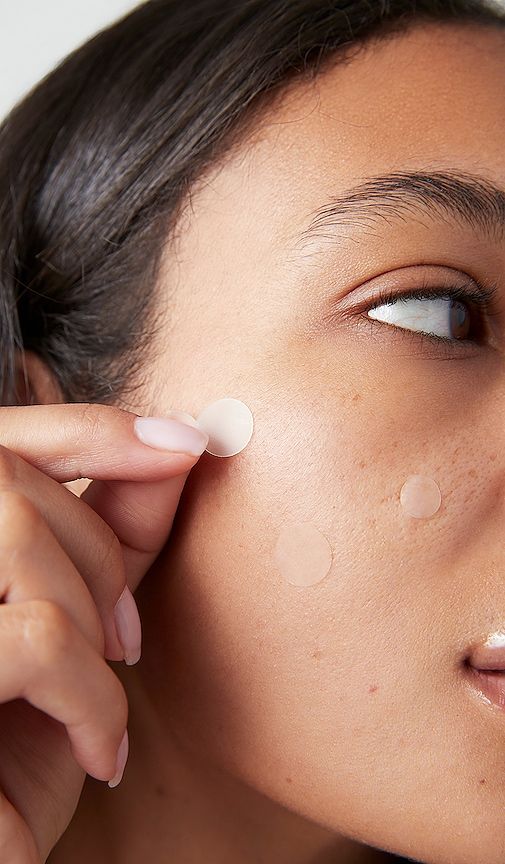 [BYE PIMPLES] Met dit stappenplan verdwijnen puisten ASAP