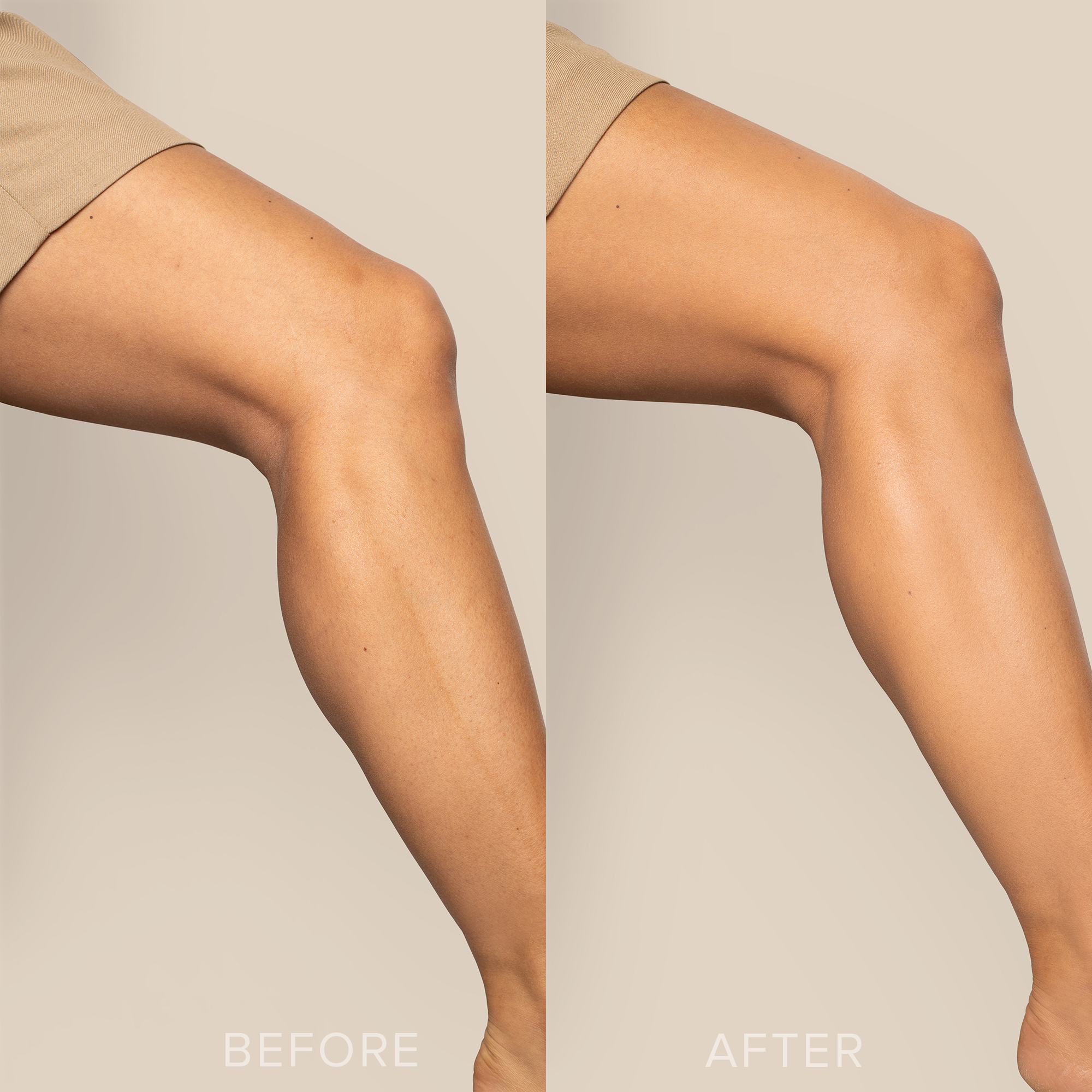BODY COVER FOUNDATION